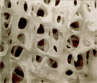 Bone Health